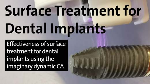 Surface Treatment for Dental Implants - Effectiveness of surface treatment for dental implants using imaginary dynamic CA