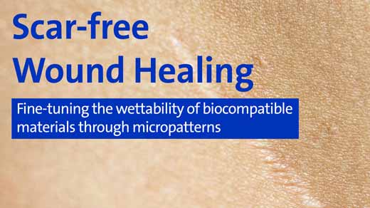 Scar-free Wound Healing - Fine-tuning the wettability of biocompatible materials through micropatterns